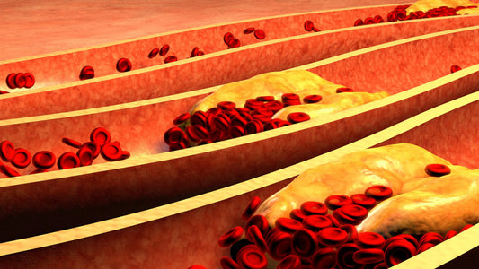 Cholesterol and juices. Can you drink juices with high cholesterol?